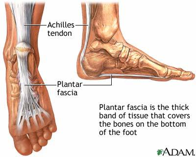Adult Acquired Flat Foot